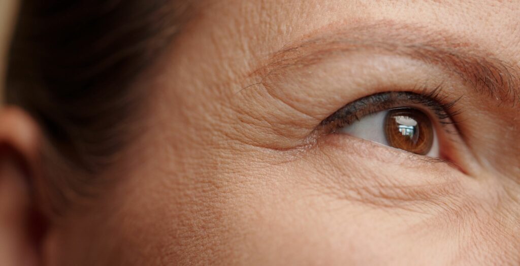 treatment for deep wrinkles, Facial treatment for deep wrinkles, Before and after deep wrinkle reduction, Anti-aging skincare for deep wrinkles, Dermal fillers used for deep wrinkle treatment, Botox injections for deep facial lines, Close-up of skin after wrinkle treatment, Professional treatment for forehead wrinkles, Minimally invasive deep wrinkle correction, Cosmetic procedure for smoother skin, Deep wrinkle treatment results on mature skin