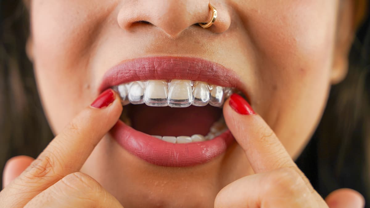 Woman inserting clear Invisalign with red nails