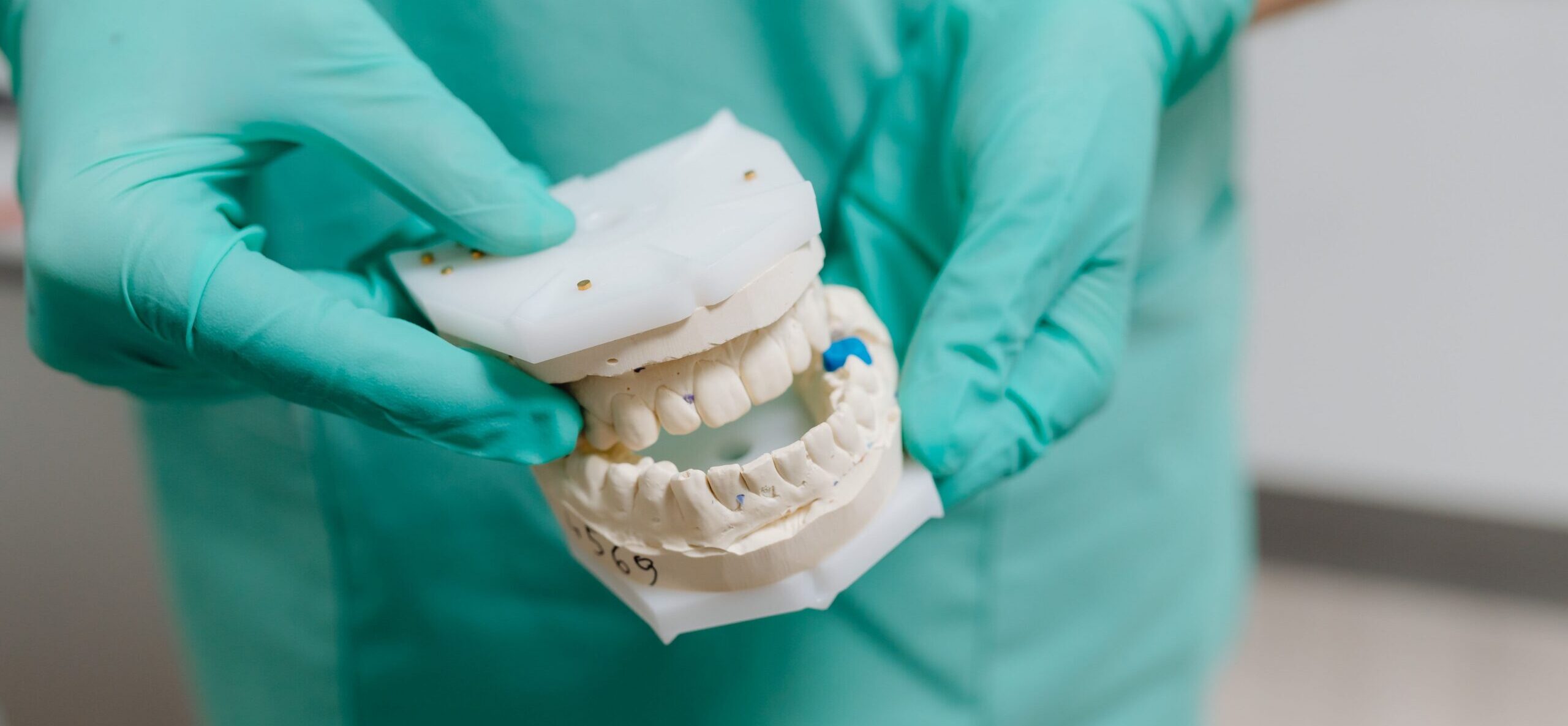 Dentist holding dental plaster cast jaw model with gloves
